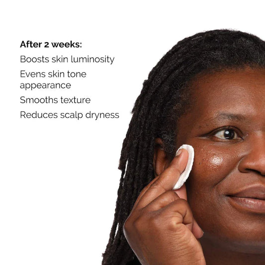 Kit Solución Tonificante Exfoliante Ácido Glicólico 7% The Ordinary