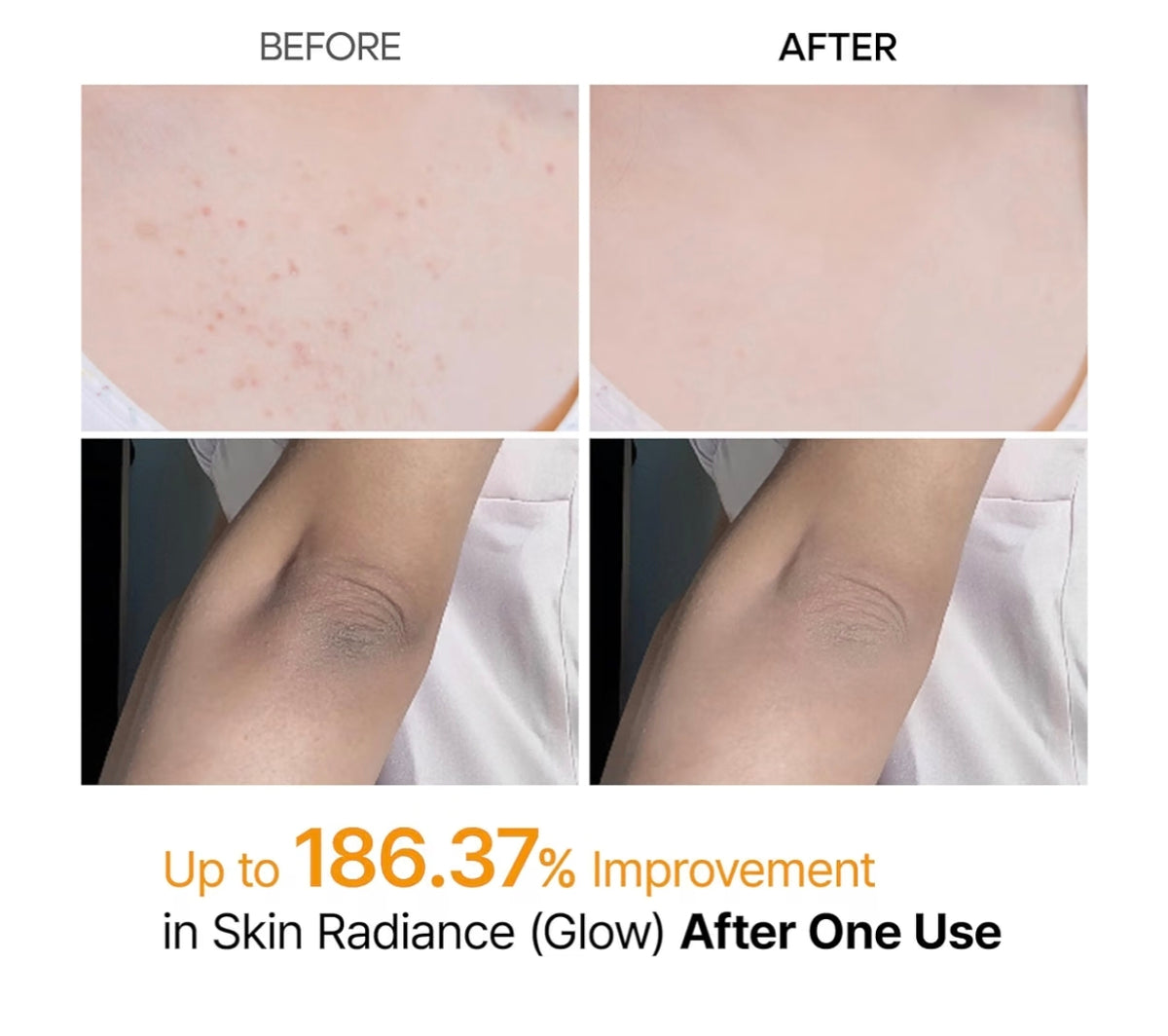 Dr.Melaxin Peel Shot Exfoliante Corporal en Spray con Ácido Kójico y Cúrcuma 200 ml