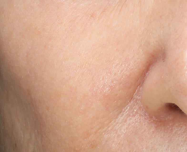 Mini exfoliante líquido perfeccionador de la piel con 6 % de ácido mandélico + 2 % de ácido láctico